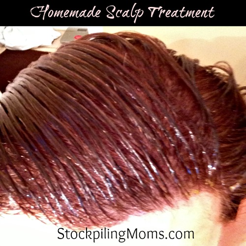 Homemade Scalp Treatment