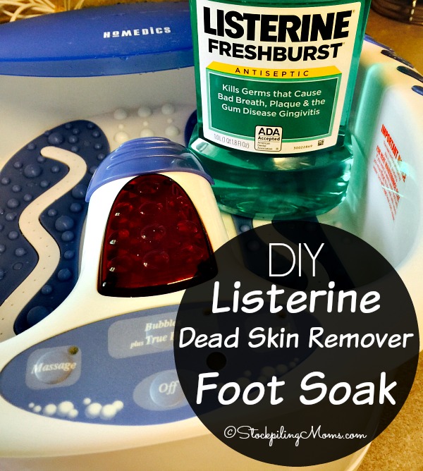 DIY Listerine Dead Skin Remover Foot Soak - STOCKPILING MOMS™