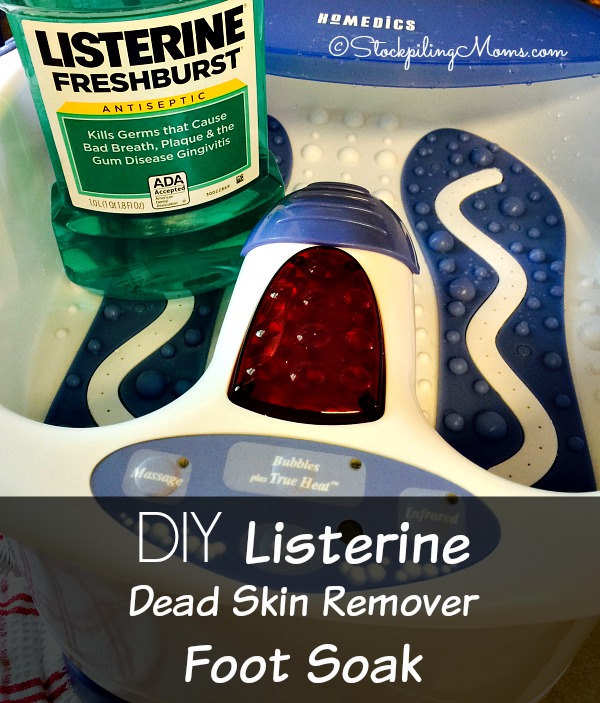 Listerine for store cracked feet